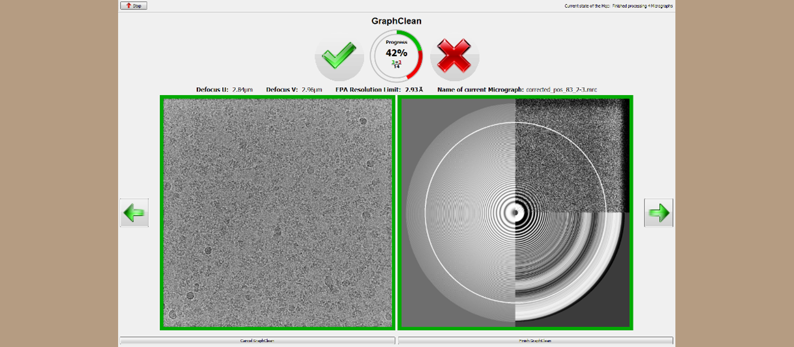 Micrograph Quality Checker Image